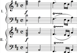 Phát hiện 'chìa khóa' trong bản nhạc của Mozart giúp xoa dịu người bệnh động kinh 